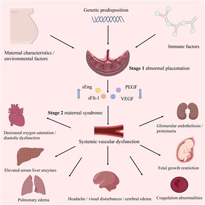 Exploring the role of exosomal MicroRNAs as potential biomarkers in preeclampsia